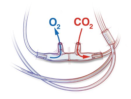 Cannula Nasal Co2 Adult ETCO2 Divided Sampling  7' O2 line & 7' CO2 line Male LL Connector (1/EA 25/CS) by AirLife  ID 4707-7-7-25